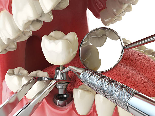 Best Broken or Cracked Tooth Emergency Dentist in Oak Park, MI